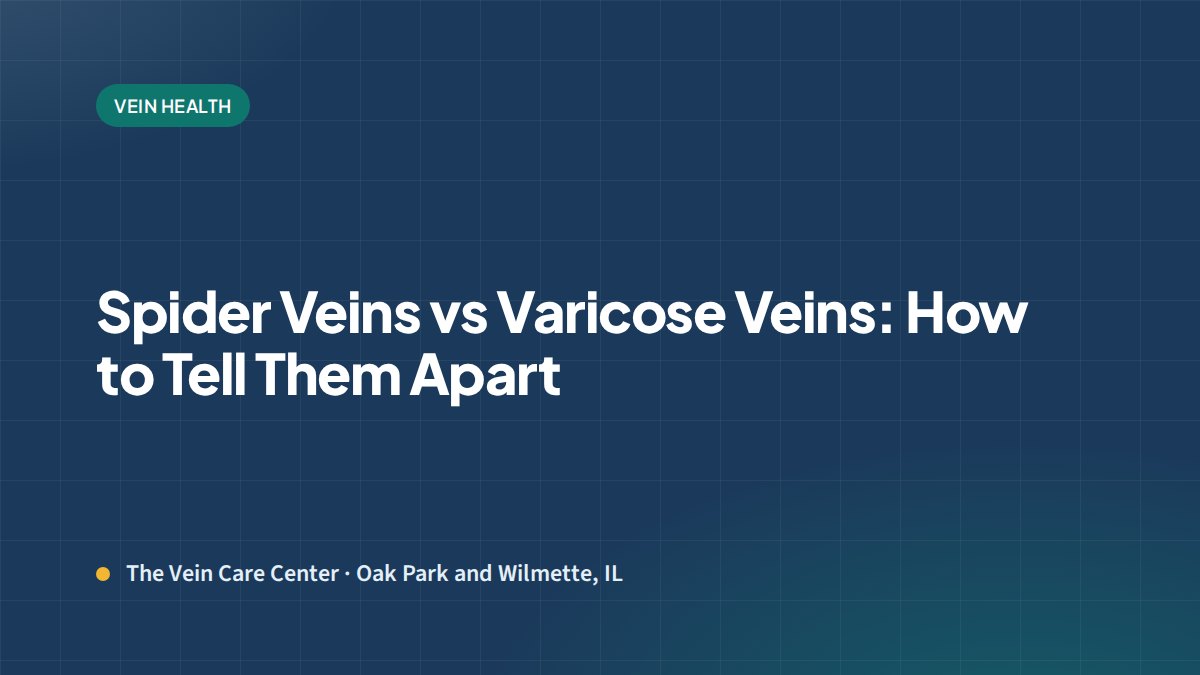 Spider Veins vs Varicose Veins: How to Tell Them Apart